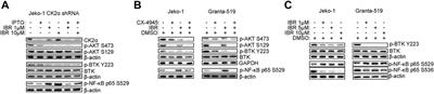 Protein Kinase CK2 represents a new target to boost Ibrutinib and Venetoclax induced cytotoxicity in mantle cell lymphoma